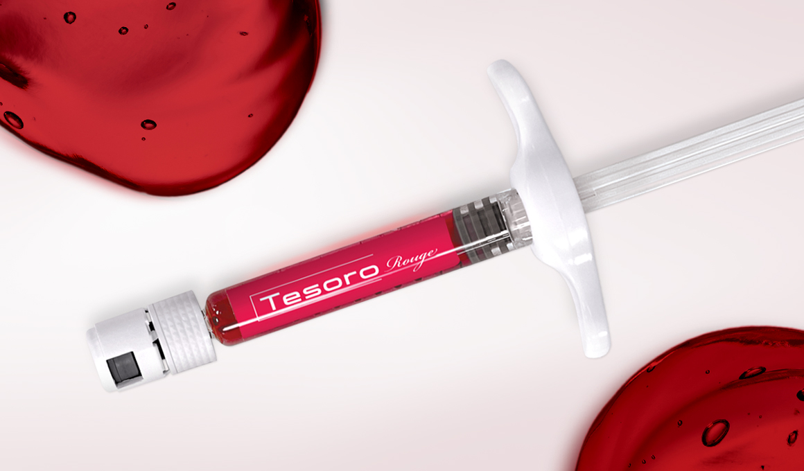 Tesoro Rouge - BNC Baltic TesoroRouge_MainVisual_1160x680_02